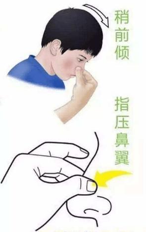 流鼻血要怎么弄才会止住?