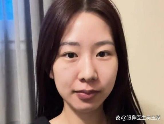 照片损坏一半被灰色覆盖