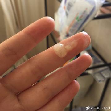 120元一针鼻炎针能打吗
