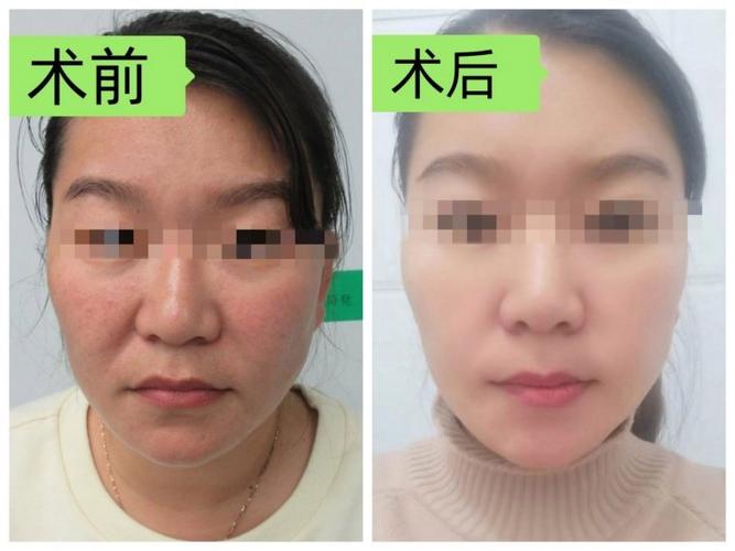 筋膜枪闪红灯一招恢复截图