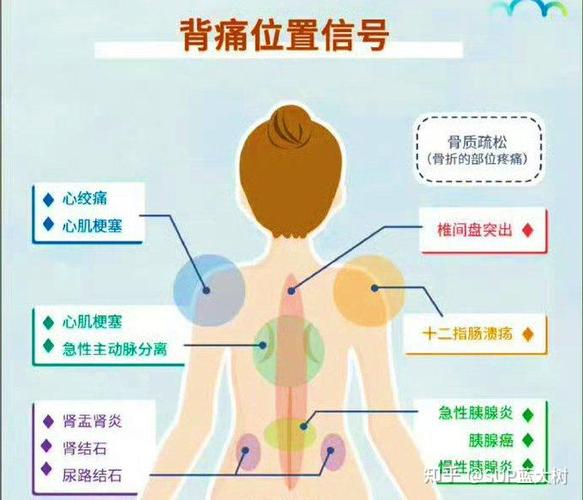 男人左背痛要当心了