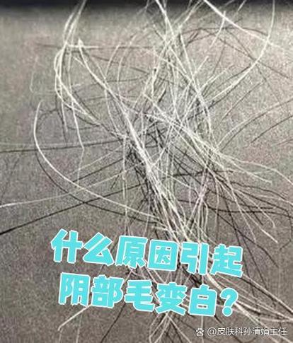 16岁下面长毛毛多正常吗