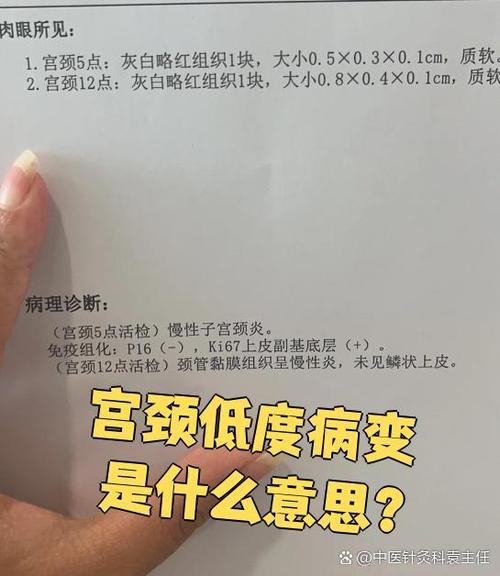 低度鳞状病变会自愈吗