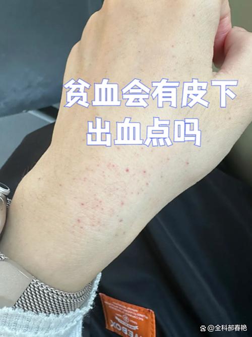 手机屏幕有针眼大小的红点