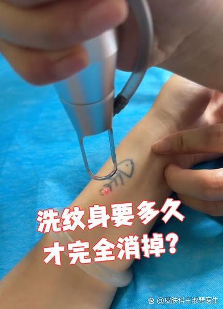 洗纹身要多久才完全消掉