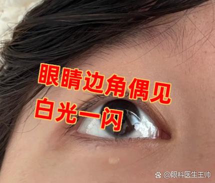 眼睛边角偶见白光一闪