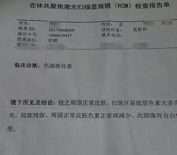 手机屏幕上有一个小白点是什么原因