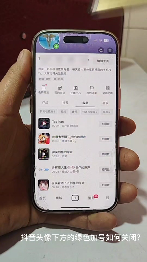 抖音为什么点那个加号点不了