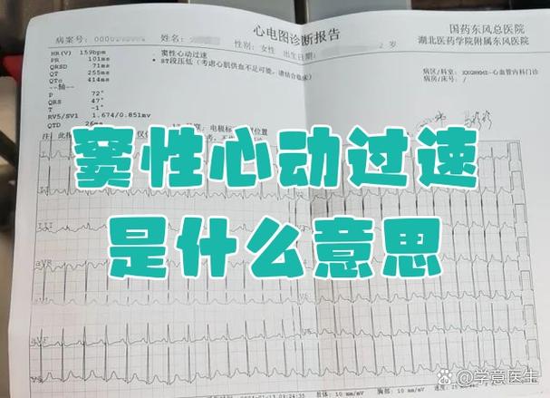 网易云音乐心动模式在哪缩略图