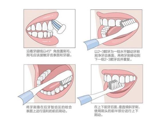 电动牙刷的正确刷法