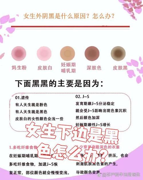 为什么女生下面黑黑的怎么回事