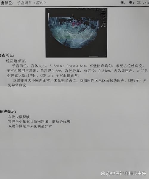 卵巢怎么检查最准确