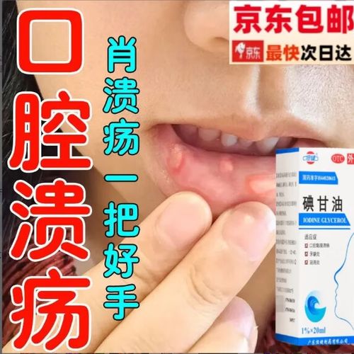 口腔溃疡专用药