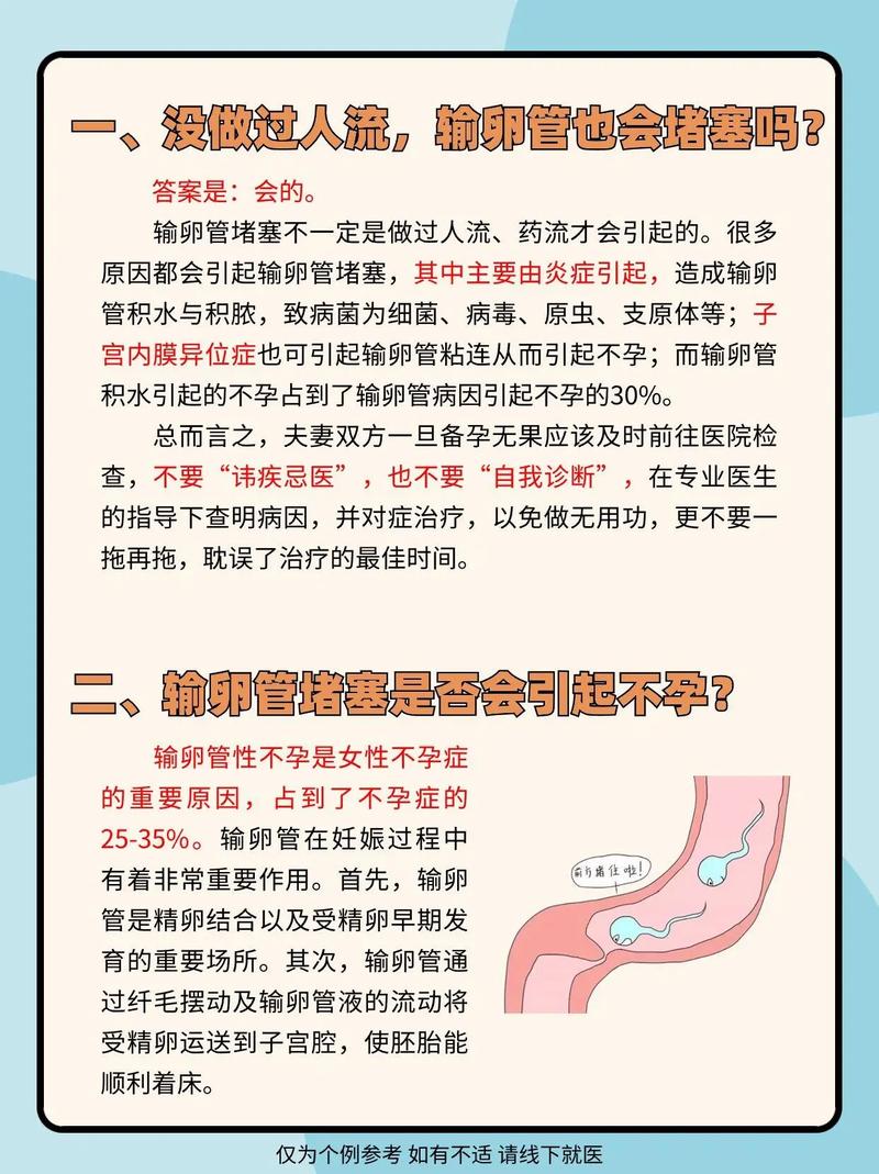 怎么自己判断输卵管是否堵塞