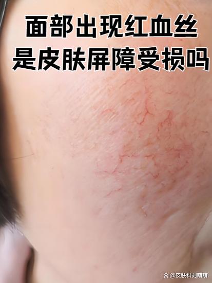 正常人脸颊是粉红色吗