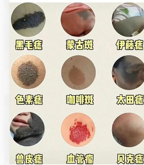 童子下凡的胎记对照表