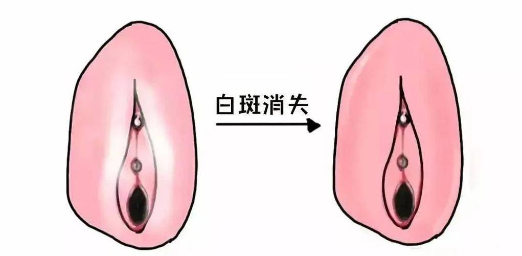 治疗外阴白斑医院排名游戏截图