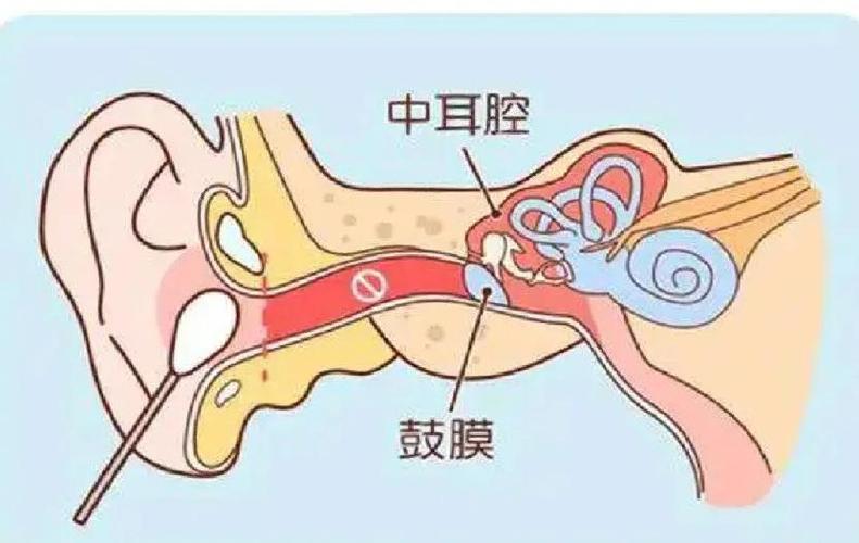 鼓膜标志欠清严重吗