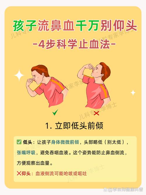 女孩流鼻血怎么处理