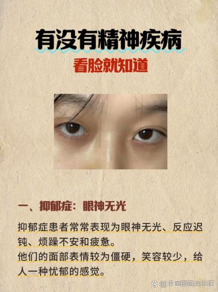 正常人患精神病是什么原因