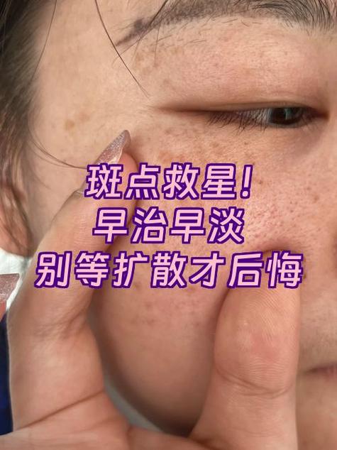 手机紫色斑块怎么消除