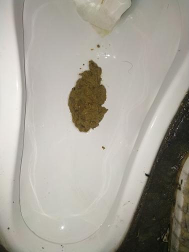 肚子咕噜响大便不成形