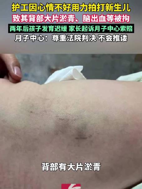 大力拍打宝宝