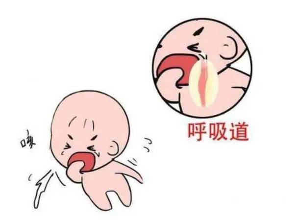 婴儿发出像噎住然后喘不了气