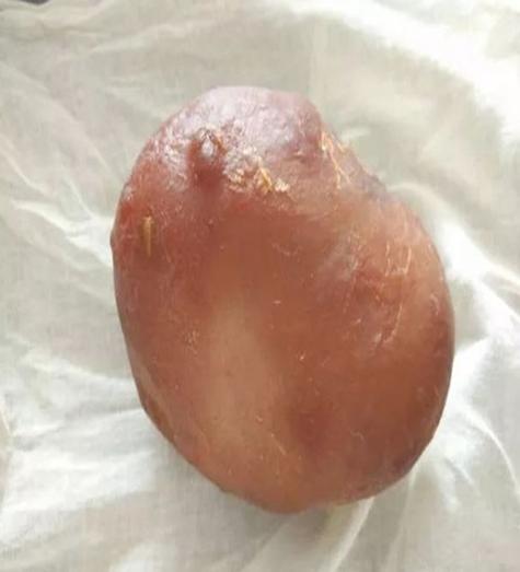 收鸡宝联系方式