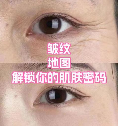 面部皮肤结构图缩略图