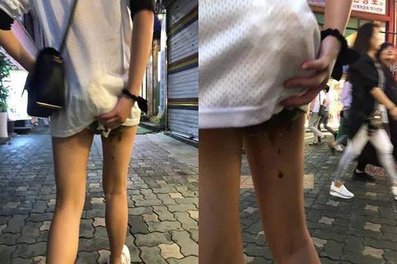 美少女拉肚子拉在裤子里视频缩略图