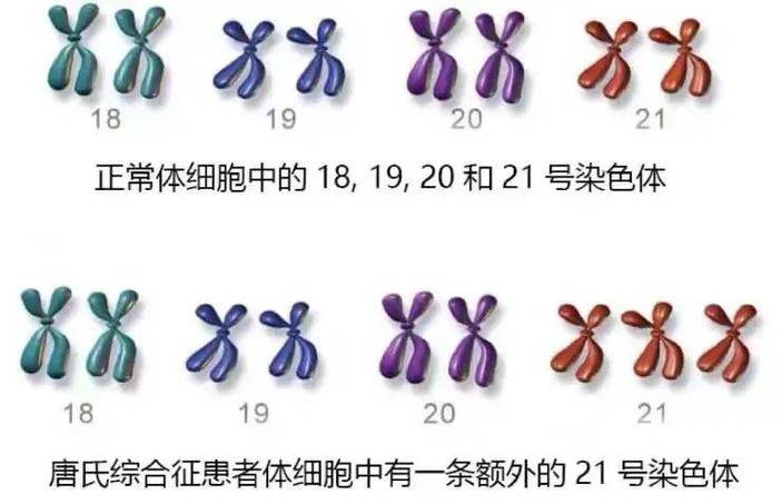 2号染色体三体还能生吗