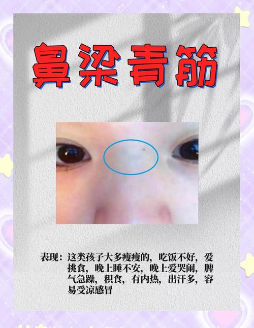 鼻梁中间有青筋是什么原因
