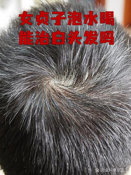 秃顶了还能长出头发吗