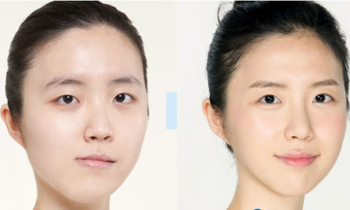 为什么前置拍出来脸是歪的