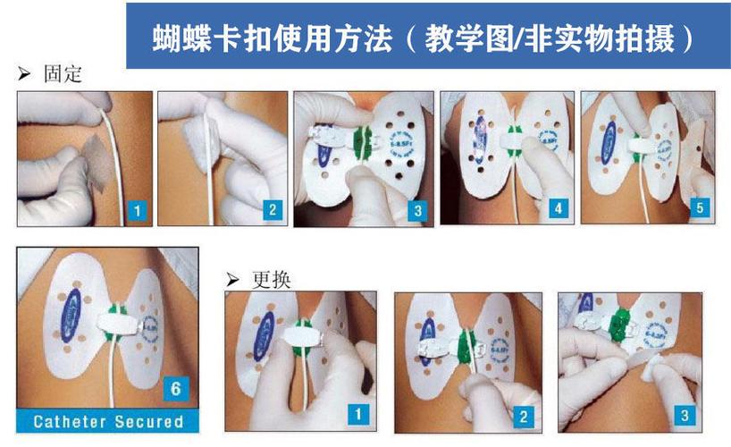 蝴蝶卡扣怎么安装视频