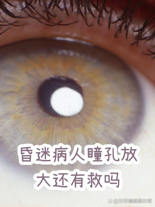 昏迷病人瞳孔放大还有救吗