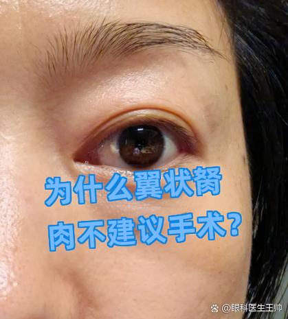 为什么胬肉不建议手术