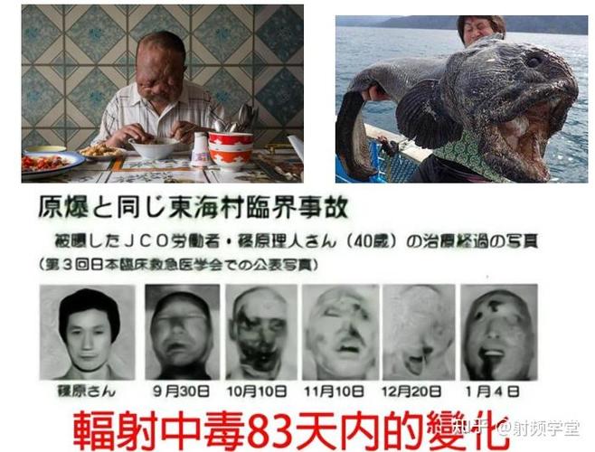 人被辐射后可以补救吗