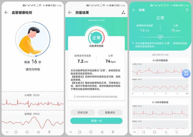 拍照识别心电图软件缩略图