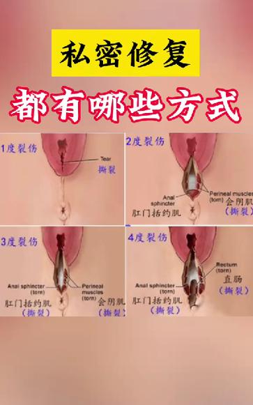 怎么让私密变回粉色