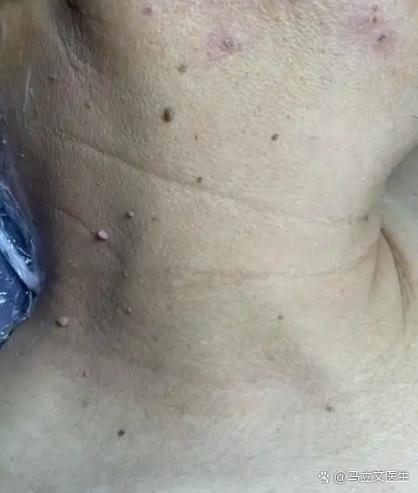 手腕处长了个硬疙瘩