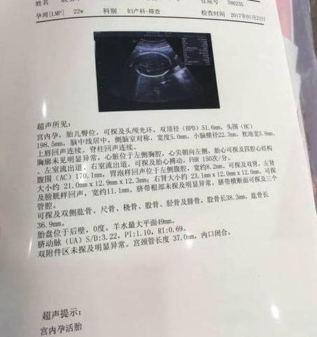 妇幼保健院b超单图片
