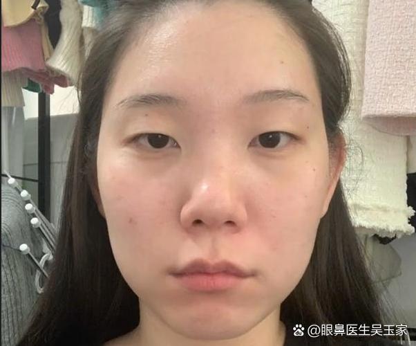 照片眼睛没睁开怎么修图