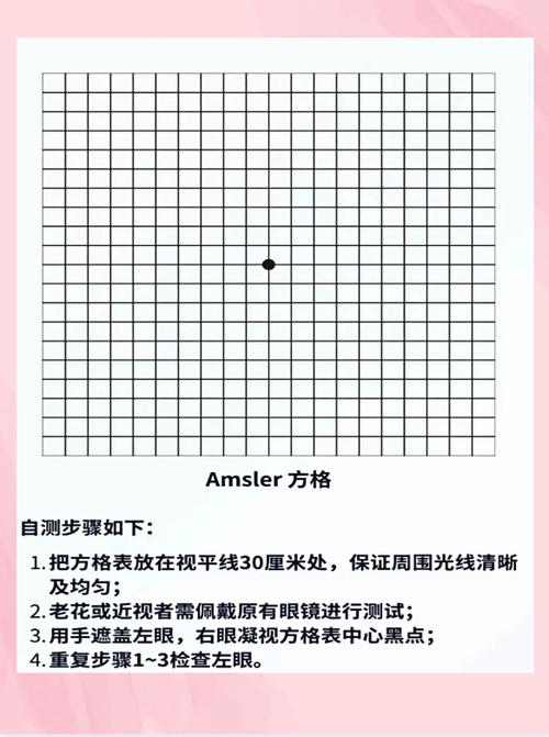 眼视野检查能看出什么