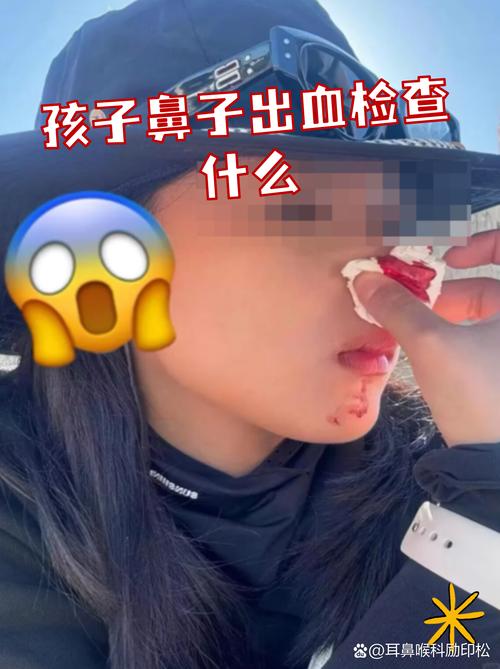 流鼻血粘稠一拉一长条