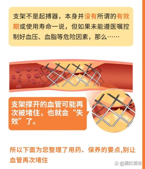 心脏做支架的人能活多久