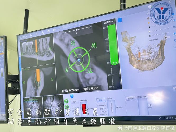 牙齿名称位置图