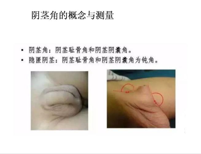 小黑盒不显示游戏时长