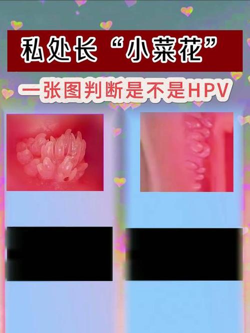 小菜花审核